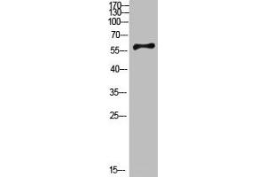Western Blot analysis of mouse-brain cells using Antibody diluted at 800. (CYP26B1 antibody  (AA 391-440))