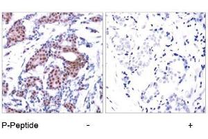 Image no. 2 for anti-ELK1, Member of ETS Oncogene Family (ELK1) (pSer383) antibody (ABIN196615) (ELK1 antibody  (pSer383))