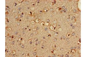 Immunohistochemistry of paraffin-embedded human brain tissue using ABIN7163337 at dilution of 1:100