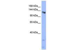 Image no. 1 for anti-Calcium Homeostasis Endoplasmic Reticulum Protein (CHERP) (AA 683-732) antibody (ABIN6742996) (CHERP antibody  (AA 683-732))