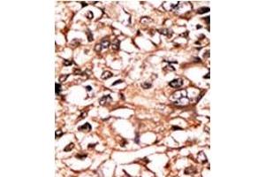 Image no. 1 for anti-Tumor Necrosis Factor Receptor Superfamily, Member 1A (TNFRSF1A) (pSer274) antibody (ABIN358242) (TNFRSF1A antibody  (pSer274))