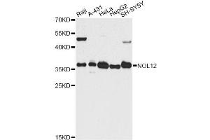 Western blot analysis of extracts of various cell lines, using NOL12 antibody. (NOL12 antibody)