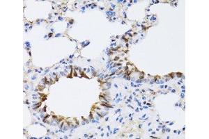 Immunohistochemistry of paraffin-embedded Rat lung using NAA10 Polyclonal Antibody at dilution of 1:100 (40x lens). (NAA10 antibody)