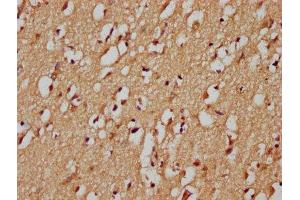 IHC image of ABIN7148390 diluted at 1:200 and staining in paraffin-embedded human brain tissue performed on a Leica BondTM system.