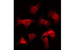 ABIN6272311 staining Hela by IF/ICC. (GZMH antibody)