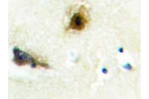 Image no. 1 for anti-Phosphofructokinase, Liver (PFKL) antibody (ABIN272176) (PFKL antibody)
