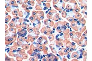 Immunohistochemistry (IHC) image for anti-Fibroblast Activation Protein, alpha (FAP) (AA 542-761) antibody (ABIN7434938)