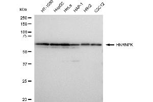 Western blotting analysis using HNRNPK antibody (ABIN7798900). (Recombinant HNRNPK antibody)