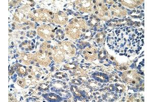 SRP14 antibody was used for immunohistochemistry at a concentration of 4-8 ug/ml to stain Epithelial cells of renal tubule (arrows) in Human Kidney.