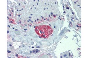 Small intestine, myenteric plexus (TUBB2A antibody  (Middle Region))