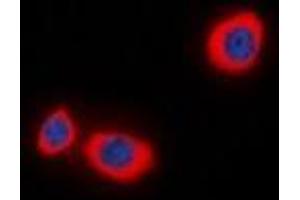 Immunofluorescent analysis of STMN1 (pS38) staining in MCF7 cells.