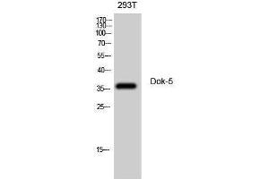 Western Blotting (WB) image for anti-Docking Protein 5 (DOK5) (Internal Region) antibody (ABIN3174809) (DOK5 antibody  (Internal Region))
