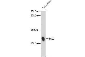 Western blot analysis of extracts of Rat spleen using TAL2 Polyclonal Antibody at dilution of 1:1000. (TAL2 antibody)