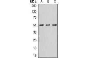 Western blot analysis of Serpin A10 expression in HepG2 (A), mouse liver (B), rat liver (C) whole cell lysates.