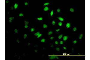 Immunofluorescence of monoclonal antibody to FOXF2 on HeLa cell. (FOXF2 antibody  (AA 346-443))