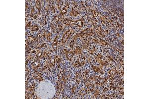 IHC analysis of SBP/SELENBP1 using anti-SBP/SELENBP1 antibody (ABIN7600755). (SELENBP1 antibody  (AA 23-462))