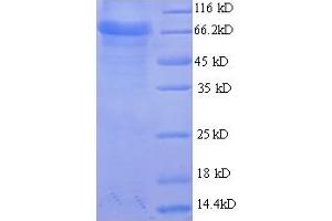 Aspartyl Aminopeptidase (DNPEP) (AA 1-475), (full length) protein (His-SUMO Tag)