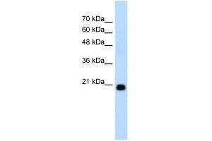 FBXO25 antibody used at 1. (FBXO25 antibody  (C-Term))
