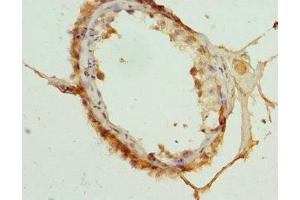 Immunohistochemistry (IHC) image for anti-Cyclin-Dependent Kinase Inhibitor 2D (p19, Inhibits CDK4) (CDKN2D) (AA 1-166) antibody (ABIN7148893)