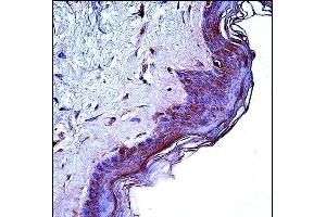 CD1A Antibody (Center) (ABIN657461 and ABIN2846488) immunohistochemistry analysis in formalin fixed and paraffin embedded human skin tissue followed by peroxidase conjugation of the secondary antibody and DAB staining. (CD1a antibody  (AA 75-104))