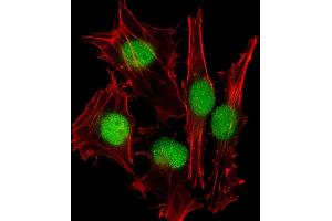 Immunofluorescent analysis of 4 % paraformaldehyde-fixed, 0. (SUMO1 antibody)