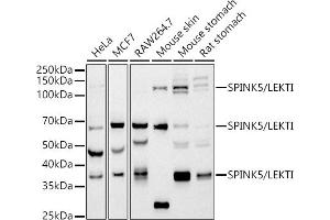 Western blot analysis of extracts of various cell lines, using SPINK5/LEKTI antibody (ABIN7270212) at 1:1000 dilution. (SPINK5 antibody)