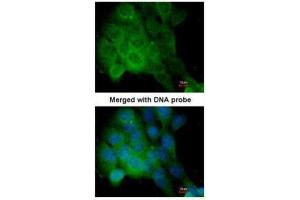 ICC/IF Image Immunofluorescence analysis of paraformaldehyde-fixed A431, using CaMKII delta, antibody at 1:200 dilution. (CAMK2D antibody)