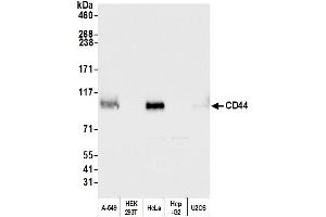Western Blotting (WB) image for anti-CD44 (CD44) (AA 692-742) antibody (ABIN7453578) (CD44 antibody  (AA 692-742))