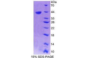 SDS-PAGE (SDS) image for Chemokine (C-X-C Motif) Ligand 14 (CXCL14) (AA 35-111) protein (His tag,GST tag) (ABIN2122511) (CXCL14 Protein (AA 35-111) (His tag,GST tag))