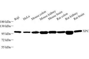 Western blot analysis of XPC (ABIN7076238) at dilution of 1: 500 (XPC antibody)