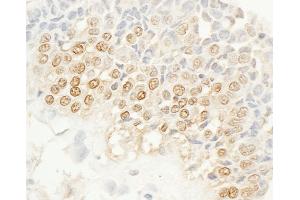 anti-NIMA related kinase 4 (NEK4) (AA 350-400) antibody