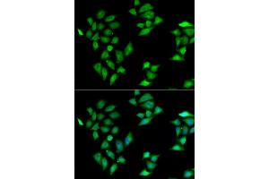 Immunofluorescence analysis of HeLa cells using ITLN1 antibody (ABIN5974359).