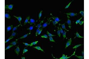 Immunofluorescent analysis of Hela cells using ABIN7153207 at dilution of 1:100 and Alexa Fluor 488-congugated AffiniPure Goat Anti-Rabbit IgG(H+L) (TIGAR antibody  (AA 24-188))