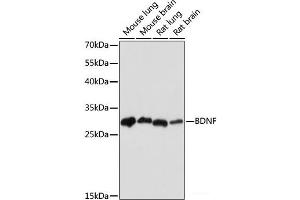 Western blot analysis of extracts of various cell lines using BDNF Monoclonal Antibody at dilution of 1:1000. (BDNF antibody)