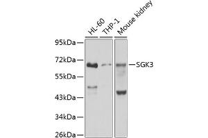 Western blot analysis of extracts of various cell lines, using SGK3 antibody (ABIN6132066, ABIN6147709, ABIN6147710 and ABIN6223495) at 1:1000 dilution. (SGK3 antibody  (AA 1-150))