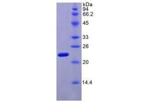 SDS-PAGE analysis of Human Relaxin 2 Protein. (Relaxin 2 Protein (RLN2))