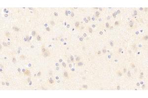 Detection of NOS1 in Rat Cerebrum Tissue using Polyclonal Antibody to Nitric Oxide Synthase 1, Neuronal (NOS1) (NOS1 antibody  (AA 9-136))