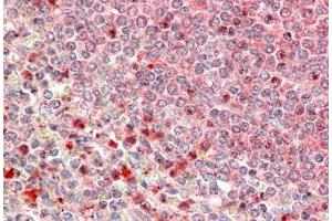 Immunohistochemistry (5μg/ml) staining of paraffin embedded Human Spleen. (UBR4 antibody  (C-Term))