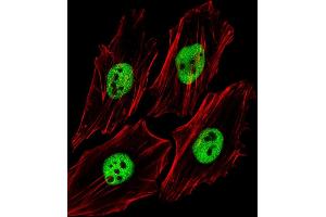 Fluorescent image of Hela cells stained with (Mouse) Trim24 Antibody (C-term) (ABIN6244019 and ABIN6577664). (TRIM24 antibody  (C-Term))
