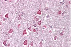 Immunohistochemistry (IHC) image for anti-Calcium Channel, Voltage-Dependent, T Type, alpha 1G Subunit (CACNA1G) (C-Term) antibody (ABIN2776348)