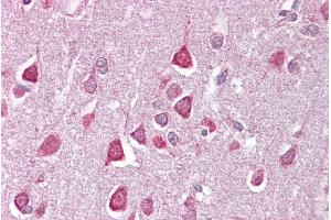 Immunohistochemistry with Brain, cortex tissue at an antibody concentration of 2. (CACNA1G antibody  (C-Term))