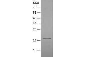 Western Blotting (WB) image for Tumor Necrosis Factor Receptor Superfamily, Member 11a, NFKB Activator (TNFRSF11A) (AA 28-202) protein (His tag) (ABIN7125546) (TNFRSF11A Protein (AA 28-202) (His tag))