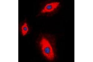 Immunofluorescent analysis of Granzyme A staining in HepG2 cells. (GZMA antibody)