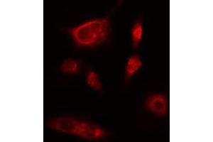 ABIN6274219 staining Hela cells by IF/ICC. (ITPKB antibody  (Internal Region))