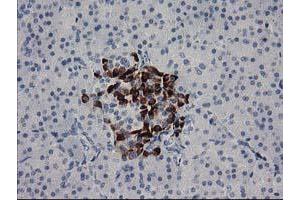 Immunohistochemical staining of paraffin-embedded Human pancreas tissue using anti-RGS5 mouse monoclonal antibody.