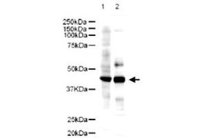 Western blot using Ldb2 polyclonal antibody  showsdetection of a 43 KDa band corresponding to Ldb2 in a lysates prepared from human kidney (Lane 1) and mouse spleen (Lane 2) tissues. (LIM Domain Binding 2 Protein antibody  (AA 107-120))