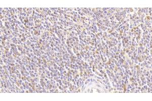 Detection of ATG16L1 in Human Spleen Tissue using Polyclonal Antibody to Autophagy Related Protein 16 Like Protein 1 (ATG16L1) (ATG16L1 antibody  (AA 1-284))