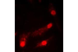 Immunofluorescent analysis of p53 (AcK386) staining in HeLa cells. (p53 antibody  (acLys386, C-Term))