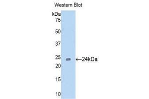 Western Blotting (WB) image for anti-Cell Division Cycle 25 Homolog B (S. Pombe) (CDC25B) (AA 377-566) antibody (ABIN1171796)