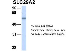 Host: Rabbit Target Name: SLC29A2 Sample Type: Human Fetal Liver Antibody Dilution: 1. (SLC29A2 antibody  (C-Term))